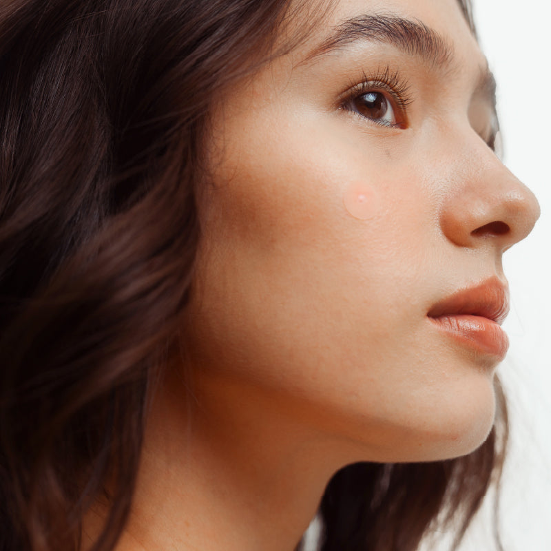 Goteskin Clear-It Acne Patches