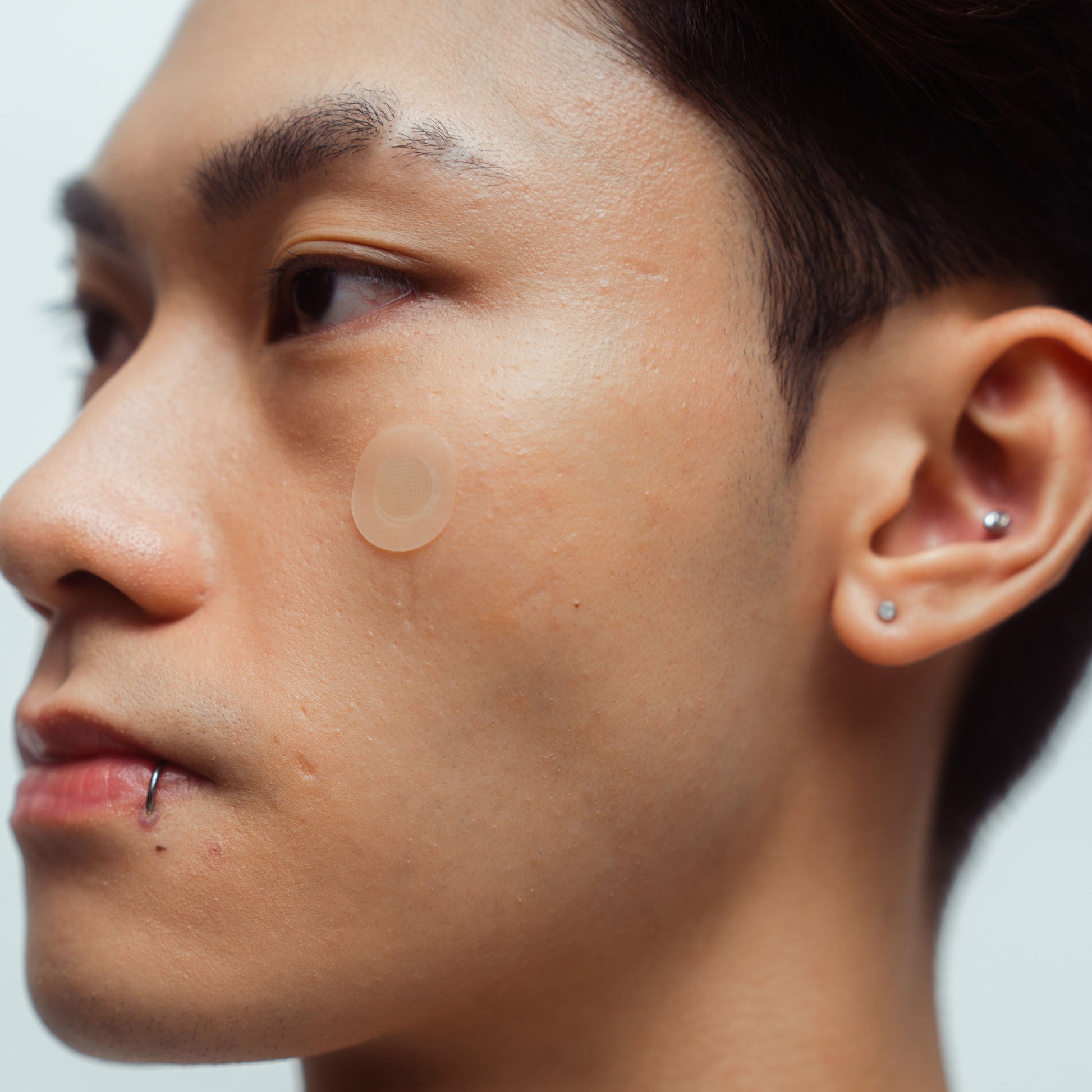 gote-goteskin-early-on-acne-patches-on-skin-application